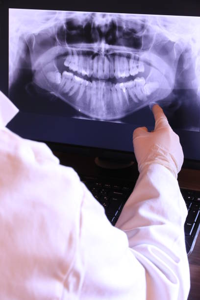 Best Dentist for Tooth Abscess  in Oak Hill, OH