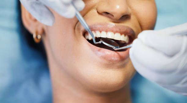 Best Chipped Tooth Repair Near Me  in Oak Hill, OH